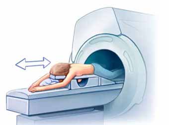 Staging breast cancer