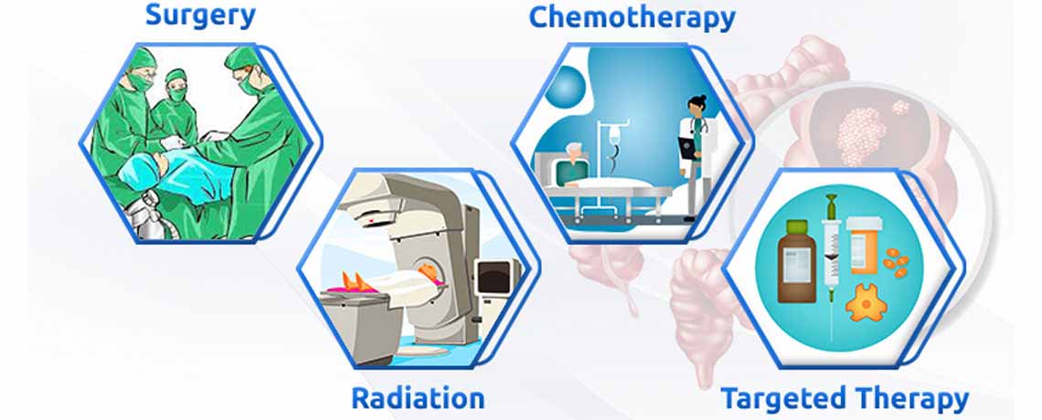 Colon Cancer & Rectal Cancer Treatment