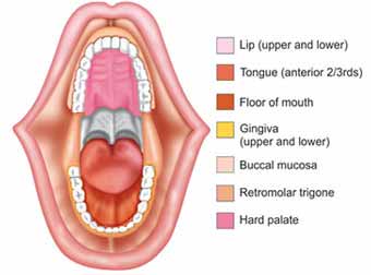 Oral Cavity Cancer